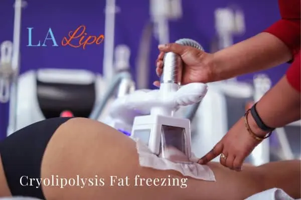 women getting fat freezing Weymouth