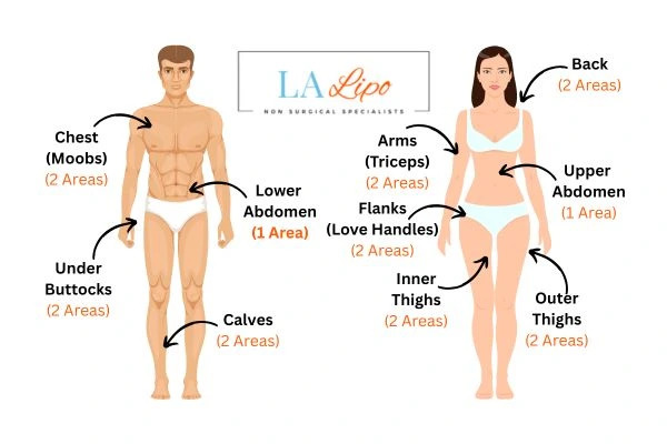 LA LIPO Cryolipolysis Areas Weymouth