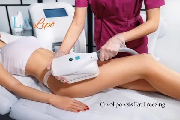 Woman receiving coolsculpting Weymouth treatment on her thighs
