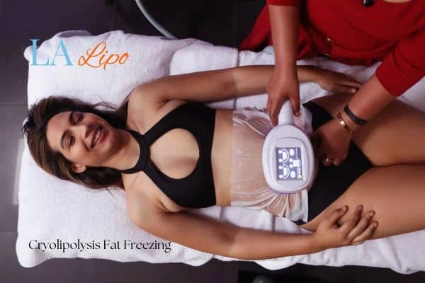 woman getting cryolipolysis Weymouth