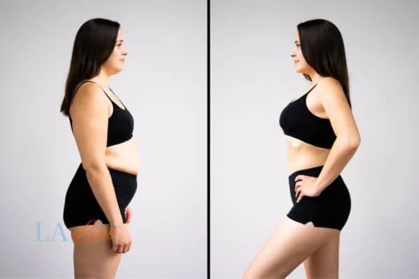 link between body image and mental health Weymouth