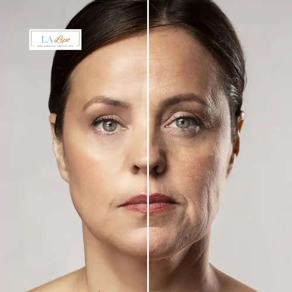 How Can You Tell If Non-Surgical Skin Tightening Is Right for You Weymouth?