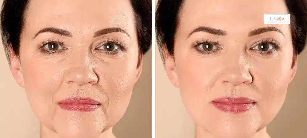 How Long Does It Take to See Results and How Long Do They Last Weymouth?